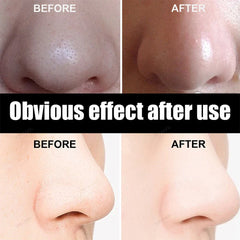 Bamboo Charcoal Nasal Strips Blackhead Remover Mask