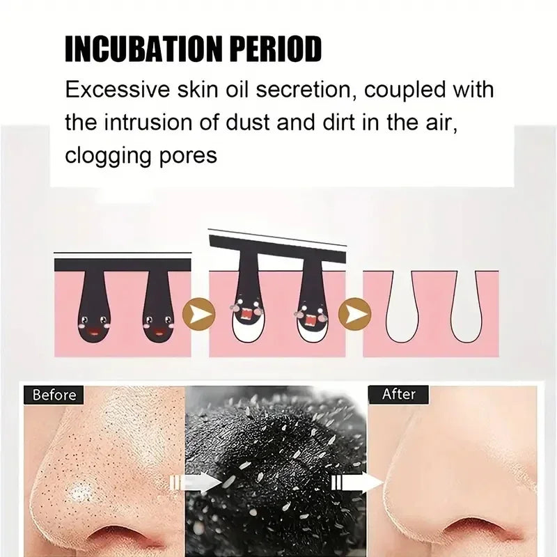 Bamboo Charcoal Nasal Strips Blackhead Remover Mask